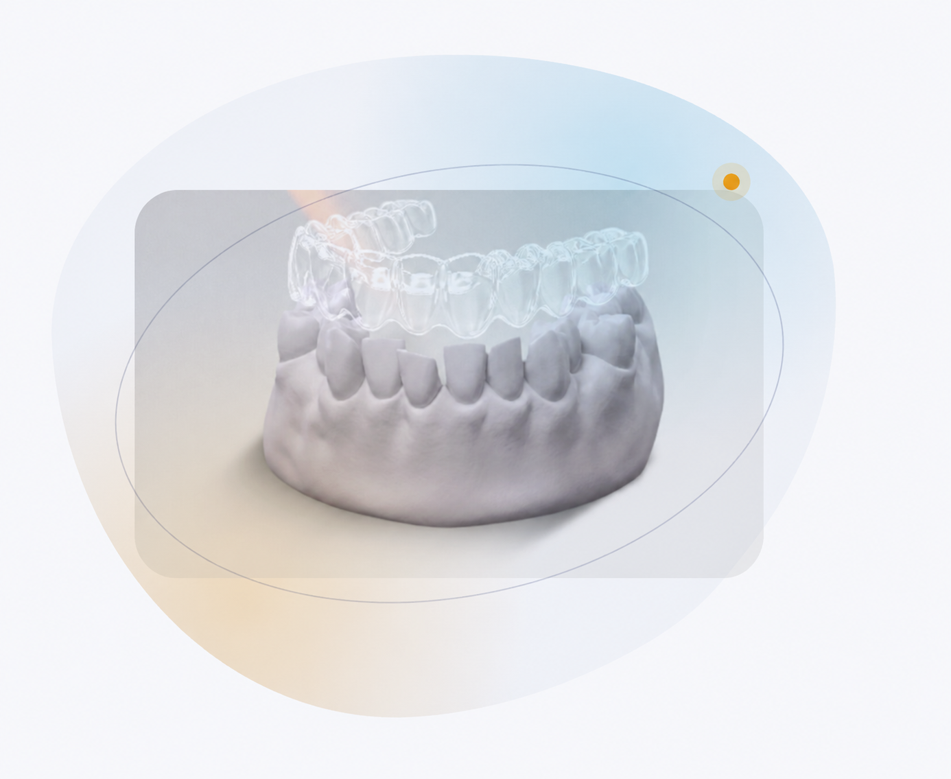 Modelo dental con alineadores transparentes para planificación digital